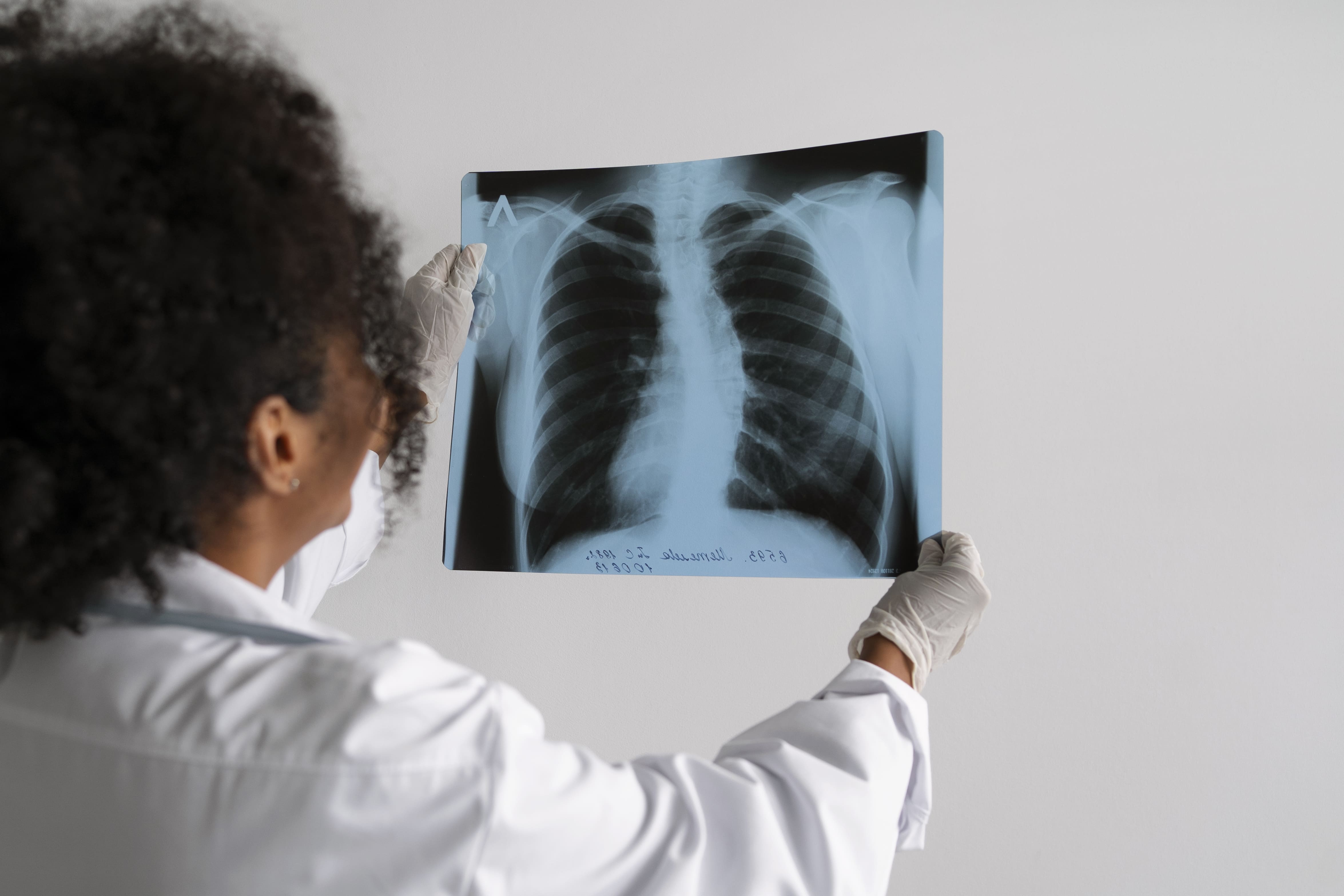 Dispositivo permite acompanhamento de idosos e pessoas com doenças respiratórias crônicas Médica analisa radiografia de pulmão