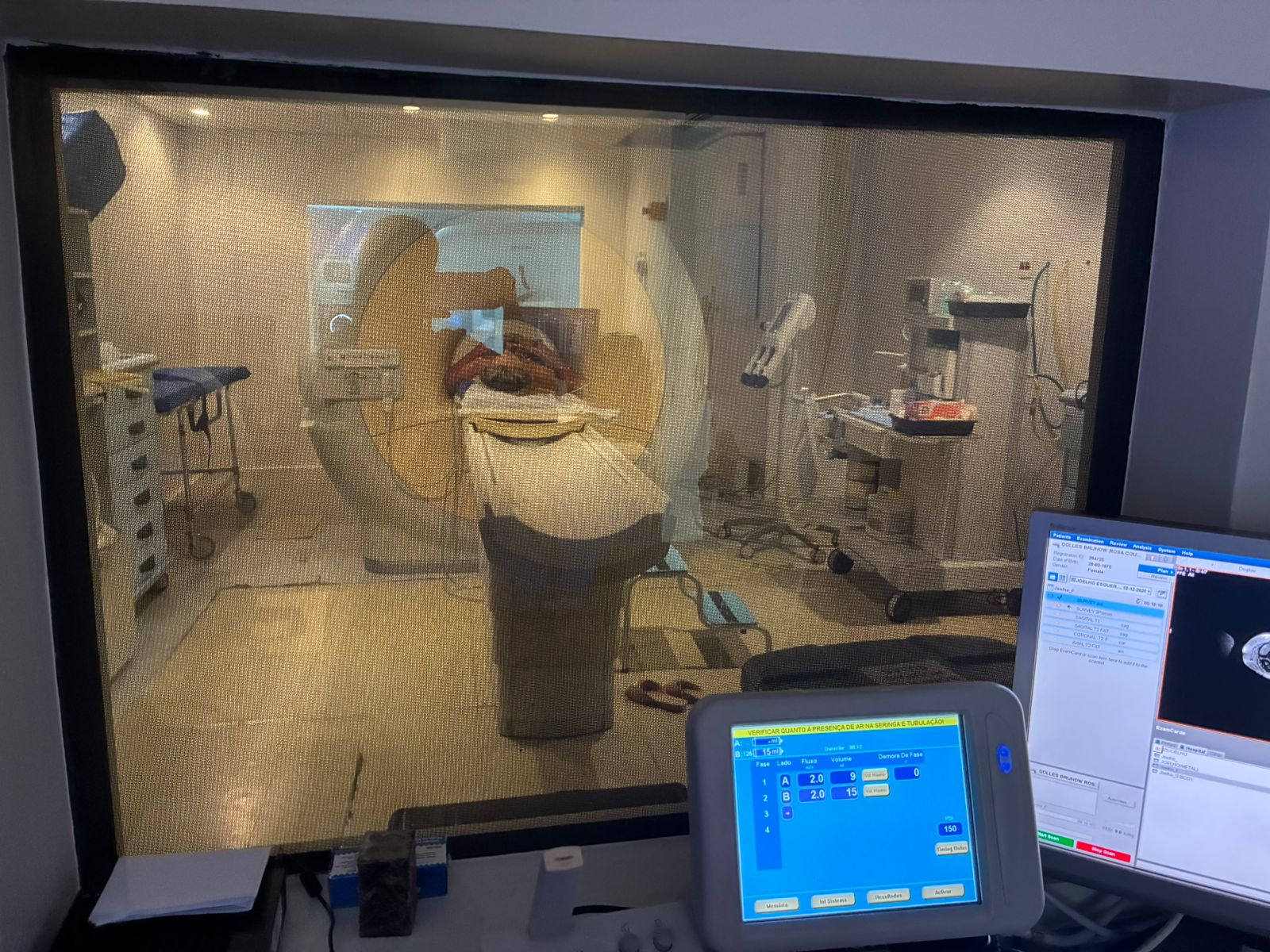 Foto de um exame de imagem realizado durante o mutirão
