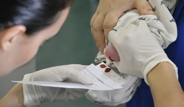 Foto de uma enfermeira coletando sangue do pé de um bebê